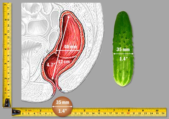 Does Anal Sex Cause Hemorrhoids 109