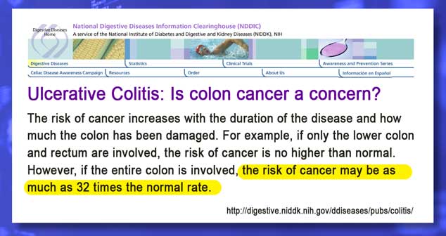 Inflammatory Bowel Disease