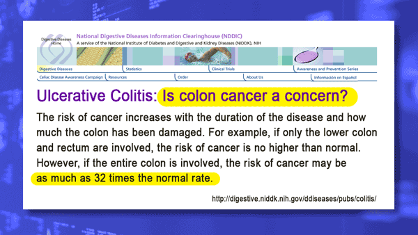 Inflammatory Bowel Disease