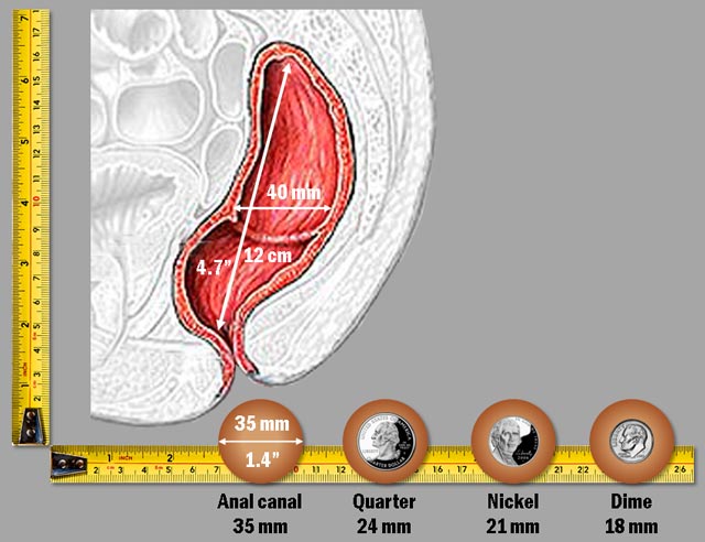 Rectal Bleeding Color Chart